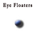 An introduction to the topic: eye (vitreous) floaters.